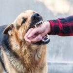dog bite