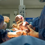 Bladder Injury