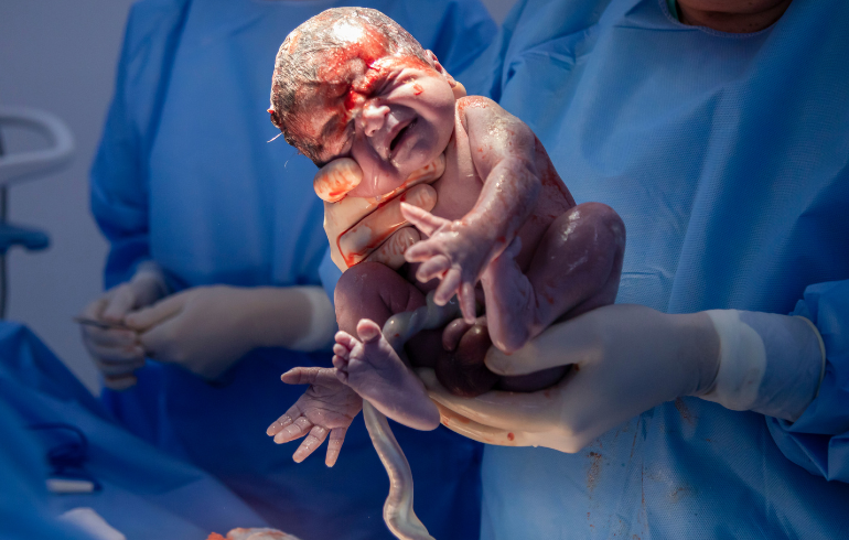 Birth Injury Cases In Martinsburg