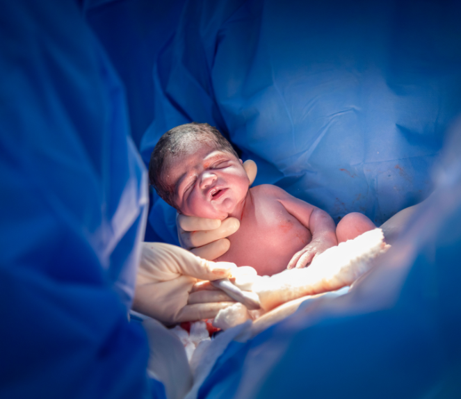 Fairmont birth injury legal claim factors